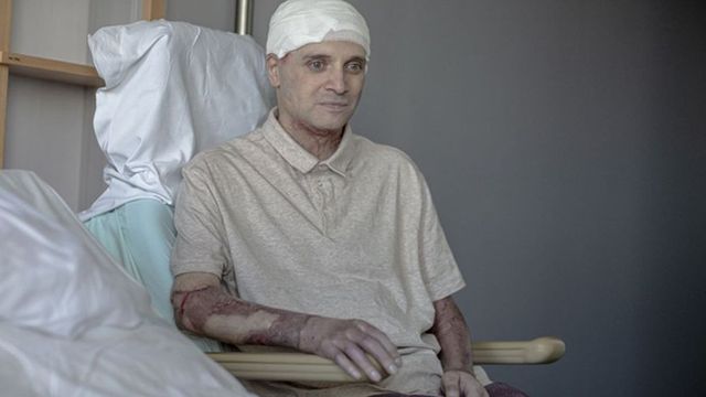 Medicul Cătălin Denciu, rănit în timpul incendiului de la Spitalul Piatra Neamț