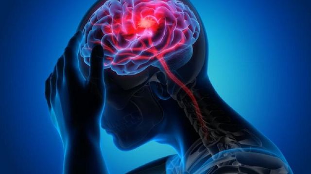 Accidentul vascular cerebral – principala cauză de handicap