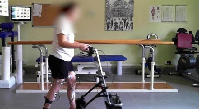 Paralizzata da 5 anni, torna a camminare con neurostimolatore
