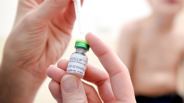 Нови случаи на морбили у нас, заразените вече са 165