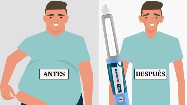 Ozempic y sus múltiples usos: de la diabetes al control de adicciones, descubre sus efectos