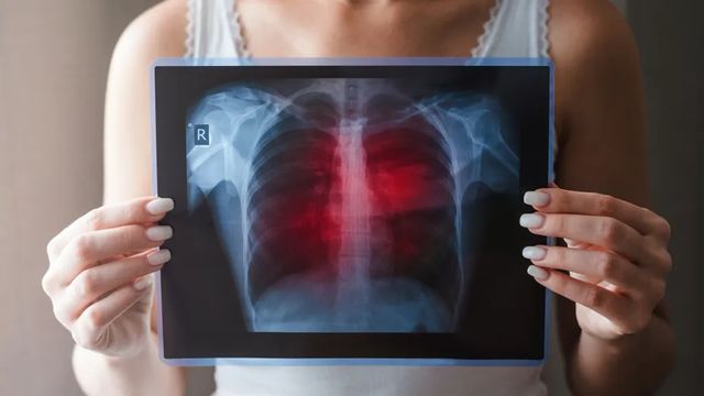 El cáncer se mantiene como la primera causa de muerte por delante de las enfermedades cardiovasculares