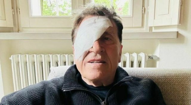 Gianni Morandi sui social con un occhio fasciato, l’ironica spiegazione: “Ho fatto a pugni”