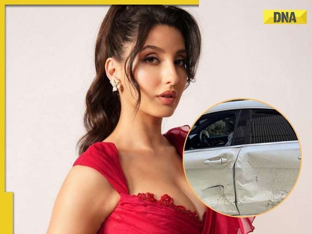 Bad news for Nora Fatehi, actress gets injured in car accident after…