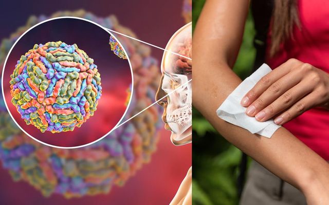 5 persoane s-au infectat cu virusul West Nile în ultima săptămână
