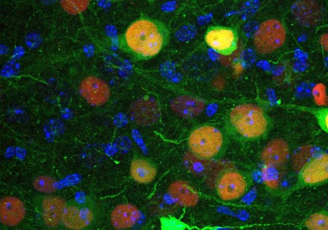 Identifican un grupo de neuronas implicado en la regulación de la ansiedad y los trastornos sociales