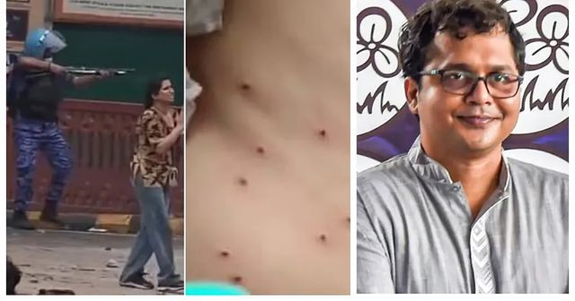 CRPF refused to share info on pellet use during student protests: Saket Gokhale