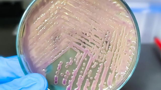 La bacteria intestinal más temida puede fabricar bioplástico por sí sola