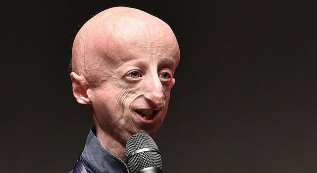 Morto a 28 anni Sammy Basso, fece conoscere agli italiani la progeria