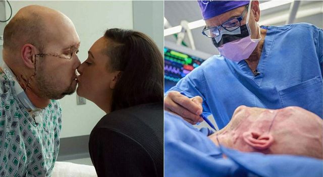 Eseguito a New York il primo trapianto di un intero occhio