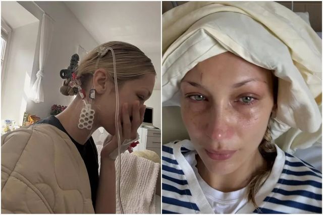 Bella Hadid posta le foto dall’ospedale, cosa è successo alla modella