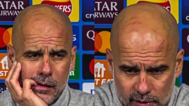 Guardiola, sobre sus extrañas heridas en la cabeza: «Quiero hacerme daño...»