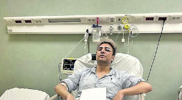 Roma, ancora un'aggressione omofoba: 25enne pestato dal branco