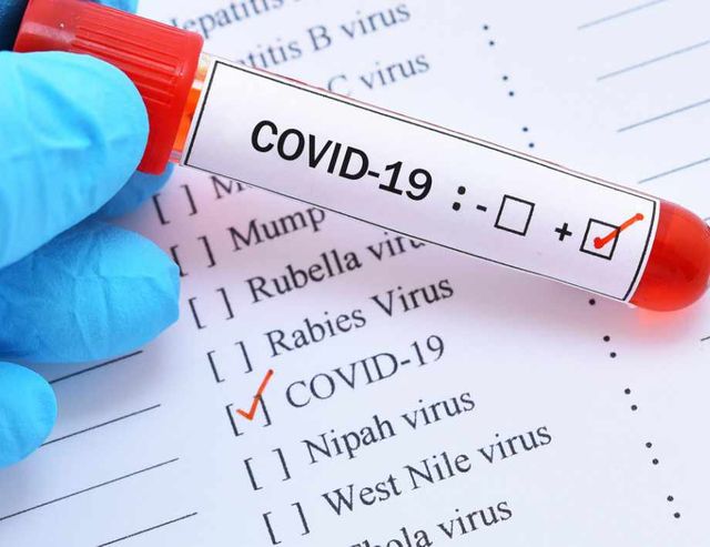 Над 7000 заразени с коронавирус за денонощие в България