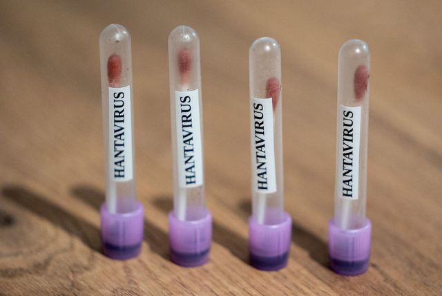 Caz suspect de hantavirus în Spania. Pacienta, contact direct cu un pasager de pe nava de croazieră Hondius