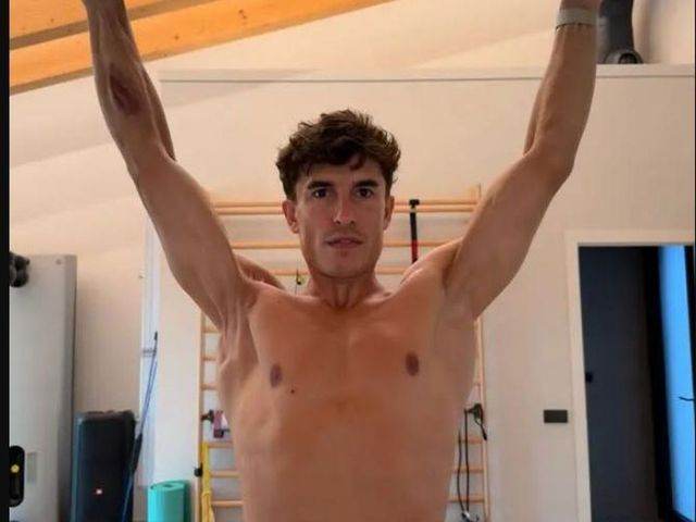 Marc Marquez, la foto impressionante della spalla dopo 7 operazioni
