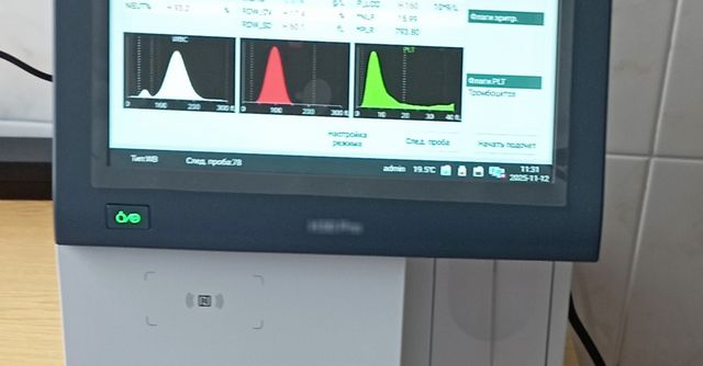 Condiții mai bune la Centrul de Sănătate Iabloana